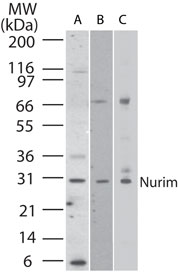 Anti-NRM antibody used in Western blot. GTX85768