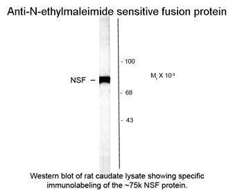 Anti-NSF (N-ethylmaleimide sensitive fusion protein) antibody used in Western blot. GTX82622