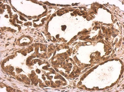 Anti-NUFIP1 antibody used in IHC (Formalin-fixed paraffin-embedded sections). GTX118425