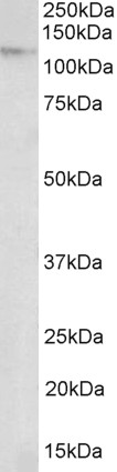 Anti-NUP107 antibody, Internal used in Western blot. GTX88032
