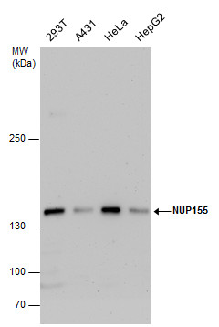 Anti-NUP155 antibody [C1C3] used in Western blot. GTX120945