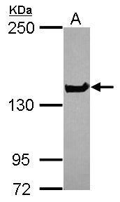Anti-NUP155 antibody [C1C3] used in Western blot. GTX120945