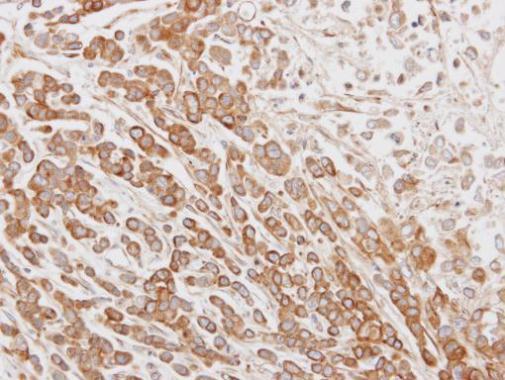 Anti-NYD-SP26 antibody [N3C3] used in IHC (Formalin-fixed paraffin-embedded sections). GTX106895