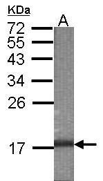 Anti-OLAH antibody used in WB-Ag. GTX122731