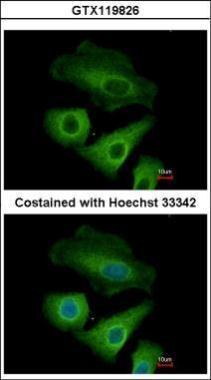 Anti-Olfactomedin-like 3 antibody [N1C1] used in ICC/IF. GTX119826