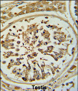 Anti-OPLAH antibody, N-term used in IHC (Formalin-fixed paraffin-embedded sections). GTX81428