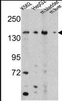 Anti-OPLAH antibody, N-term used in Western blot. GTX81428