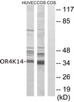 Anti-OR4K14 antibody used in Western blot. GTX87987