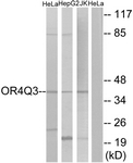 Anti-OR4Q3 antibody used in Western blot. GTX87878