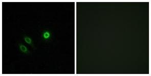 Anti-OR4X1 antibody used in ICC/IF. GTX87206