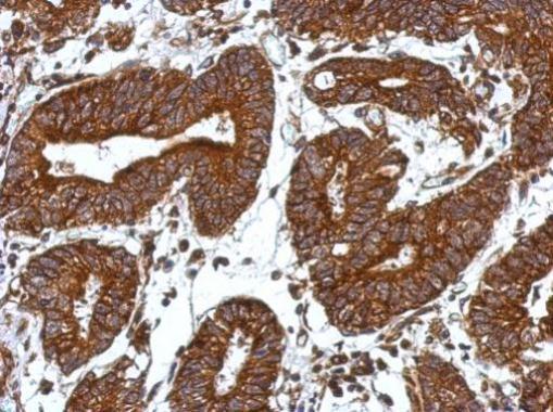 Anti-ORAI2 antibody used in IHC (Formalin-fixed paraffin-embedded sections). GTX120952