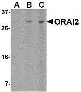 Anti-ORAI2 antibody used in Western blot. GTX85691