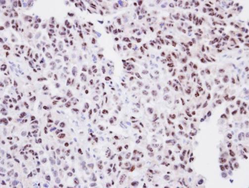 Anti-ORC2 antibody [N3C2], Internal used in IHC (Formalin-fixed paraffin-embedded sections). GTX103280