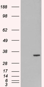 Anti-ORC6L antibody, C-term used in Western blot. GTX89996