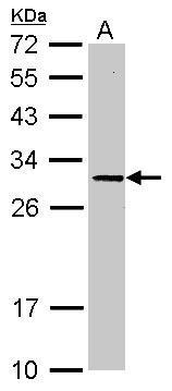 Anti-ORNT1 antibody [N1C3-2] used in Western blot. GTX109432