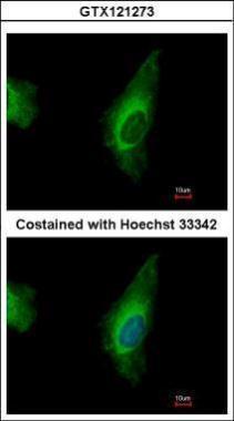 Anti-ORP8 antibody used in ICC/IF. GTX121273