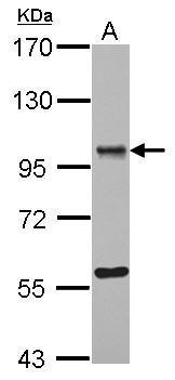 Anti-OSBPL9 antibody [C2C3], C-term used in Western blot. GTX121992