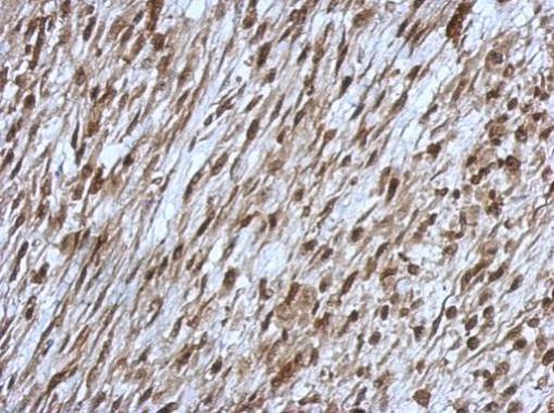 Anti-OSBPL9 antibody [C2C3], C-term used in IHC (Formalin-fixed paraffin-embedded sections). GTX121992