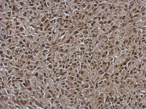 Anti-OSBPL9 antibody [C2C3], C-term used in IHC (Formalin-fixed paraffin-embedded sections). GTX121992