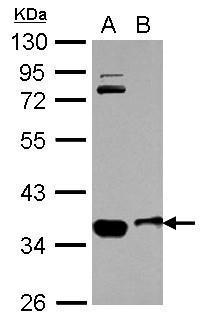 Anti-OSTM1 antibody [N1C3] used in Western blot. GTX110670