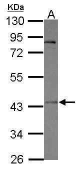 Anti-OTUD5 antibody [C1C3] used in Western blot. GTX120546