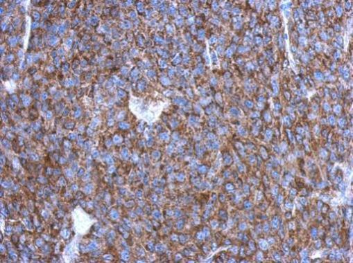 Anti-OVCA2 antibody [N1C3] used in IHC (Formalin-fixed paraffin-embedded sections). GTX119385