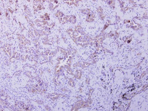 Anti-OXSM antibody used in IHC (Formalin-fixed paraffin-embedded sections). GTX123463