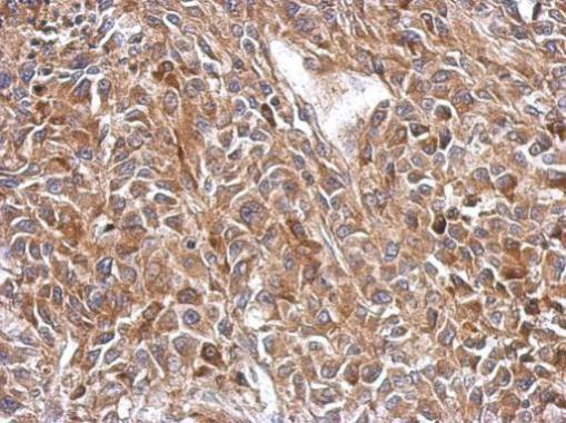 Anti-OXSM antibody used in IHC (Formalin-fixed paraffin-embedded sections). GTX123463