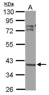 Anti-OXSM antibody used in Western blot. GTX123463