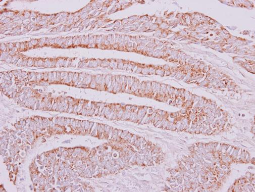 Anti-OXSM antibody used in IHC (Formalin-fixed paraffin-embedded sections). GTX123464