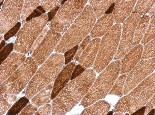 Anti-OXSM antibody used in IHC (Formalin-fixed paraffin-embedded sections). GTX123464