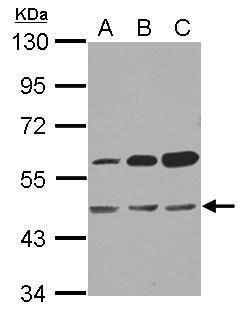 Anti-OXSM antibody used in Western blot. GTX123464