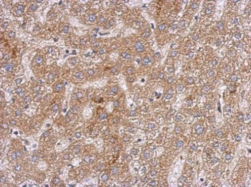 Anti-OXSM antibody used in IHC (Formalin-fixed paraffin-embedded sections). GTX124011