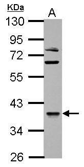 Anti-OXSM antibody used in Western blot. GTX124011