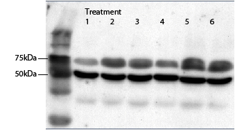 Anti-OXTR antibody, C-term used in Western blot. GTX88534