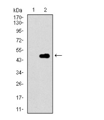 Anti-p14ARF antibody [1D7D2] used in Western blot. GTX60663