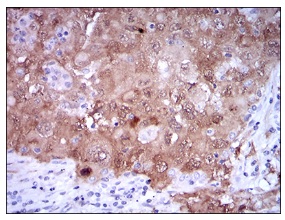 Anti-p14ARF antibody [1D7D2] used in IHC (Formalin-fixed paraffin-embedded sections). GTX60663