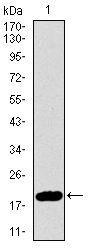 Anti-p14ARF antibody [1D7D2] used in Western blot. GTX60663