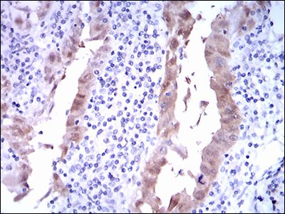 Anti-p14ARF antibody [1D7D2] used in IHC (Formalin-fixed paraffin-embedded sections). GTX60663