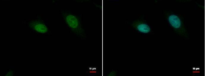 Anti-p37 antibody used in ICC/IF. GTX70287