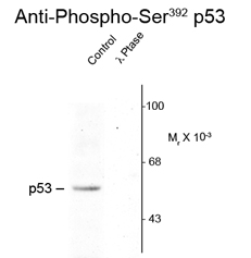 Anti-p53 (phospho Ser392) antibody used in Western blot. GTX23257