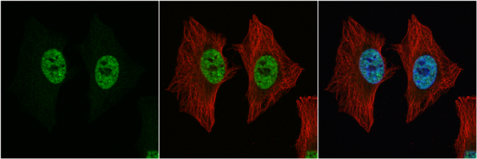 Anti-p54/nrb antibody used in ICC/IF. GTX101419