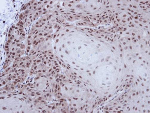 Anti-p54/nrb antibody used in IHC (Formalin-fixed paraffin-embedded sections). GTX101419