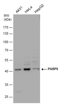 Anti-PABP5 antibody [N1C2] used in Western blot. GTX119883