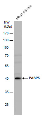 Anti-PABP5 antibody [N1C2] used in Western blot. GTX119883