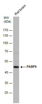 Anti-PABP5 antibody [N1C2] used in Western blot. GTX119883