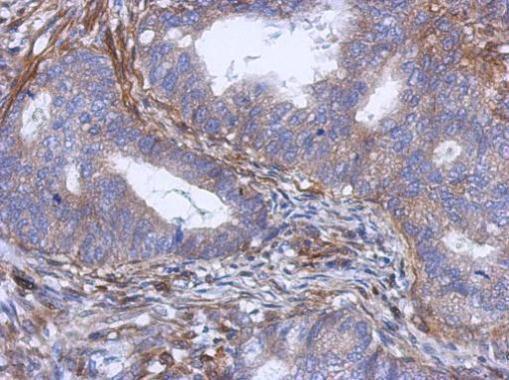 Anti-PABP5 antibody [N1C2] used in IHC (Formalin-fixed paraffin-embedded sections). GTX119883