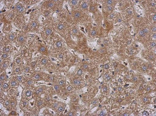 Anti-PABPC3 antibody used in IHC (Formalin-fixed paraffin-embedded sections). GTX114611