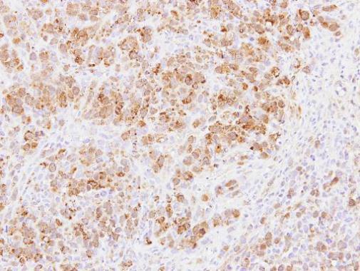 Anti-PABPC3 antibody [N2C1], Internal used in IHC (Formalin-fixed paraffin-embedded sections). GTX114612