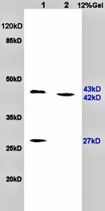 Anti-PACAP antibody used in Western blot. GTX37576